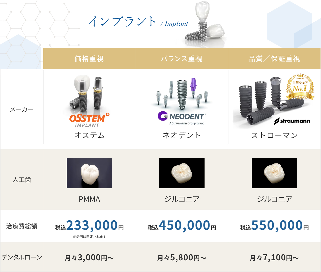 インプラント料金表