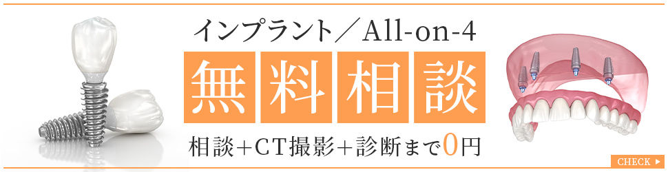 インプラント／All-on-4無料相談